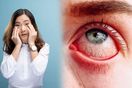 coronavirus update cases news symptoms eyes conjunctivitis red swollen sensitive 