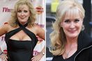 coronation street beverley callard hip surgery accident liz mcdonald news latest update